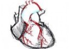 El infarto del miocardio | Recurso educativo 51902