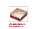 Angiogénesis terapéutica | Recurso educativo 51904