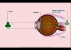 O ollo e o enfoque | Recurso educativo 741016